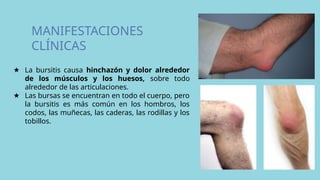 MANIFESTACIONES
CLÍNICAS
★ La bursitis causa hinchazón y dolor alrededor
de los músculos y los huesos, sobre todo
alrededor de las articulaciones.
★ Las bursas se encuentran en todo el cuerpo, pero
la bursitis es más común en los hombros, los
codos, las muñecas, las caderas, las rodillas y los
tobillos.
 