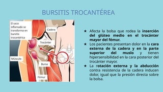 BURSITIS TROCANTÉREA
★ Afecta la bolsa que rodea la inserción
del glúteo medio en el trocánter
mayor del fémur.
★ Los pacientes presentan dolor en la cara
externa de la cadera y en la parte
superior del muslo y tienen
hipersensibilidad en la cara posterior del
trocánter mayor.
★ La rotación externa y la abducción
contra resistencia de la cadera inducen
dolor, igual que la presión directa sobre
la bolsa.
 