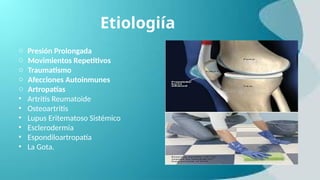 Etiologiía
o Presión Prolongada
o Movimientos Repetitivos
o Traumatismo
o Afecciones Autoinmunes
o Artropatías
• Artritis Reumatoide
• Osteoartritis
• Lupus Eritematoso Sistémico
• Esclerodermia
• Espondiloartropatía
• La Gota.
 