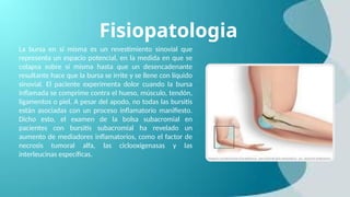 Fisiopatologia
La bursa en sí misma es un revestimiento sinovial que
representa un espacio potencial, en la medida en que se
colapsa sobre sí misma hasta que un desencadenante
resultante hace que la bursa se irrite y se llene con líquido
sinovial. El paciente experimenta dolor cuando la bursa
inflamada se comprime contra el hueso, músculo, tendón,
ligamentos o piel. A pesar del apodo, no todas las bursitis
están asociadas con un proceso inflamatorio manifiesto.
Dicho esto, el examen de la bolsa subacromial en
pacientes con bursitis subacromial ha revelado un
aumento de mediadores inflamatorios, como el factor de
necrosis tumoral alfa, las ciclooxigenasas y las
interleucinas específicas.
 