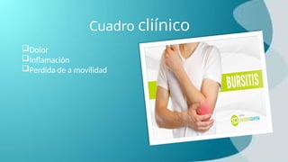 Cuadro cliínico
Dolor
Inflamación
Perdida de a movilidad
 