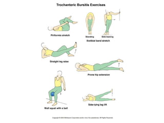 Bursitis trocantereana