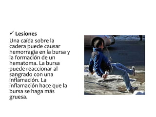  Lesiones
Una caída sobre la
cadera puede causar
hemorragia en la bursa y
la formación de un
hematoma. La bursa
puede reaccionar al
sangrado con una
inflamación. La
inflamación hace que la
bursa se haga más
gruesa.
 