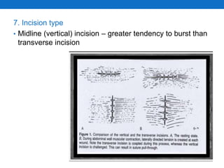 7. Incision type
• Midline (vertical) incision – greater tendency to burst than
transverse incision
 