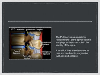 The PLC serves as a posterior
"tension band" of the spinal column
and plays an important role in the
stability of the spine.
A torn PLC has a tendency not to
heal and can lead to progressive
kyphosis and collapse.
 