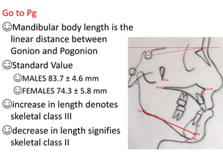 Go to Pg
☺Mandibular body length is the
linear distance between
Gonion and Pogonion
☺Standard Value
☺MALES 83.7 ± 4.6 mm
☺FEMALES 74.3 ± 5.8 mm
☺increase in length denotes
skeletal class III
☺decrease in length signifies
skeletal class II
 
