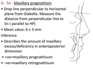 G - Sn - Maxillary prognathism
• Drop line perpendicular to horizontal
plane from Glabella. Measure the
distance from perpendicular line to
Sn ( parallel to HP)
• Mean value: 6 ± 3 mm
Inference
• Describes the amount of maxillary
excess/deficiency in anteroposterior
dimension
• +ve=maxillary prognathisum
• –ve=maxillary retrognathisum
 