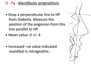 G - Pg - Mandibular prognathism
• Drop a perpendicular line to HP
from Glabella. Measure the
position of the pogonion from this
line parallel to HP.
• Mean value: 0 +/- 4
• Increased –ve value indicated
mandibal is retrognathic .
 