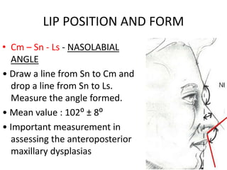 LIP POSITION AND FORM
• Cm – Sn - Ls - NASOLABIAL
ANGLE
• Draw a line from Sn to Cm and
drop a line from Sn to Ls.
Measure the angle formed.
• Mean value : 102⁰ ± 8⁰
• Important measurement in
assessing the anteroposterior
maxillary dysplasias
 