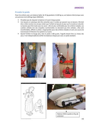 ANNEXES
143
Prendre le poids
Peser les enfants avec une balance Salter de 25 kg graduée à 0,100 kg ou une balance électronique avec
une précision de 0,100 kgs (type UNISCALE).
• N’oubliez pas de réajuster la balance à 0 avant chaque pesée.
• Une bassine en plastique doit être attachée avec 4 cordes qui passent sous la bassine. Elle doit
être à 10cm environ du sol pour éviter que l’enfant ne bascule et pour qu’il se sente en sécurité.
La bassine peut être lavée avec du savon : elle est plus confortable pour les enfants malades. Les
culottes utilisées lors des enquêtes nutritionnelles ne devraient pas être utilisées ; elles sont
inconfortables, difficile à utiliser, inappropriées pour des enfants malades et sont une source de
transmission d’infection d’un patient à un autre.
• Quand l’enfant ne bouge plus, lisez le poids à 100 g près, l’aiguille devant être au niveau des
yeux. Il est indispensable de vérifier les balances chaque jour avec un poids standard.
Balance SECA à poids à 10 g de
précision
 