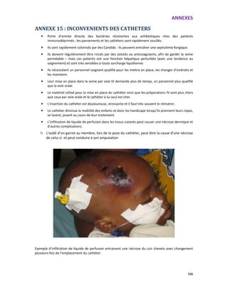 ANNEXES
166
ANNEXE 15 : INCONVENIENTS DES CATHETERS
• Porte d’entrée directe des bactéries résistantes aux antibiotiques chez des patients
immunodéprimés ; les pansements et les cathéters sont rapidement souillés.
• Ils sont rapidement colonisés par des Candida : ils peuvent entraîner une septicémie fongique.
• Ils doivent régulièrement être rincés par des solutés ou anticoagulants, afin de garder la veine
perméable – mais ces patients ont une fonction hépatique perturbée (avec une tendance au
saignement) et sont très sensibles à toute surcharge liquidienne.
• Ils nécessitent un personnel soignant qualifié pour les mettre en place, les changer d’endroits et
les maintenir.
• Leur mise en place dans la veine par voie IV demande plus de temps, un personnel plus qualifié
que la voie orale.
• Le matériel utilisé pour la mise en place du cathéter ainsi que les préparations IV sont plus chers
que ceux par voie orale et le cathéter à lui seul est cher.
• L’insertion du cathéter est douloureuse, stressante et il faut très souvent le réinsérer.
• Le cathéter diminue la mobilité des enfants et donc les handicape lorsqu’ils prennent leurs repas,
se lavent, jouent au cours de leur traitement.
• L’infiltration de liquide de perfusion dans les tissus cutanés peut causer une nécrose dermique et
d’autres complications.
L’oubli d’un garrot au membre, lors de la pose du cathéter, peut être la cause d’une nécrose
de celui-ci et peut conduire à son amputation
Exemple d’infiltration de liquide de perfusion entrainant une nécrose du cuir chevelu avec changement
plusieurs fois de l’emplacement du cathéter.
 
