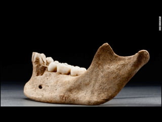 “that nothing was Spared
to maintain Life and to do those
things which seem incredible, as to
dig up dead corpses out of graves
and to eat them. And some have
Licked up the Blood which had
fallen from their weak fellows.”
 