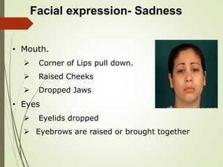 Facial expression- Sadness
• Mouth.
 Corner of Lips pull down.
 Raised Cheeks
 Dropped Jaws
• Eyes
 Eyelids dropped
 Eyebrows are raised or brought together
 