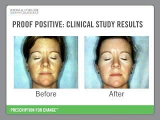 PROOF POSITIVE: CLINICAL STUDY RESULTS




      Before                After
 