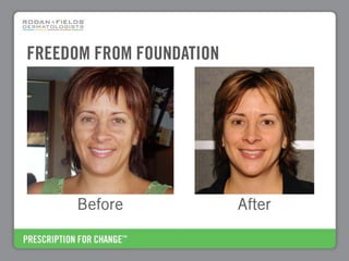 FREEDOM FROM FOUNDATION




      Before              After
 
