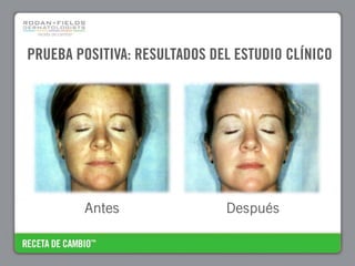 PRUEBA POSITIVA: RESULTADOS DEL ESTUDIO CLÍNICO




        Antes                 Después
 