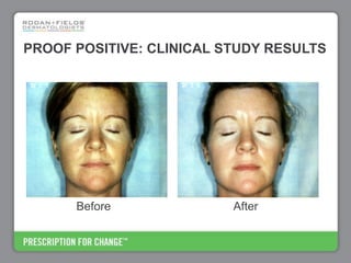 Rodan+Fields Business Opportunity