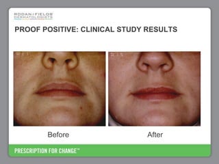 Rodan+Fields Business Opportunity