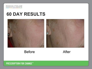 Rodan+Fields Business Opportunity