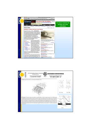 Un nuevo sistema de
         anclaje que esta
            patentado
OEPM
OEPM
 