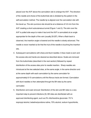 placed over the AVF above the cannulation site to enlarge the AVF. The direction
of the needle and choice of the buttonhole site is dictated by the patient in the
self-cannulation method. The needle tip is aligned over the cannulation site with
the bevel up. The skin puncture site should be at a distance of 3-5 mm from the
AVF creating a short subcutaneous tunnel (Figure 1 and 2). The skin over the
AVF is pulled side ways to make it taut and the AVF is cannulated at an angle
appropriate for the depth of the vein (usually 20-250). When a flash back is
observed, the insertion angle is lowered and the needle is slowly advanced. The
needle is never inserted so far that the hub of the needle is touching the insertion
site.
4. Subsequent cannulations with sharp and blunt needles: A face mask is worn and
the access site and hands are cleaned as described above. Scabs are removed
from the buttonholes (described in the next section) followed by repeat
disinfection of the access sites prior to needle insertion. Sharp needles are
introduced at the two selected sites, at the same angle, in the same direction and
at the same depth with each cannulation by the same cannulator for
approximately 6-10 cannulations until the fibrous tracts are formed. Cannulation
with blunt needles is then attempted through the BH sites by the same
cannulator.
5. Disinfection and scab removal: Disinfection of the skin and BH sites is a very
important step to prevent infections (9). BH sites are disinfected with an
approved disinfecting agent, such as 2% chlorhexidine gluconate / 70 %
isopropyl alcohol, betadine/povidone iodine, 70% alcohol, sodium hypochlorite,
 