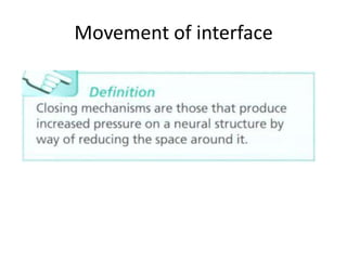 Movement of interface

 