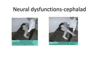 Neural dysfunctions-cephalad

 