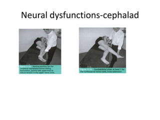 neural mobilization Slide 67