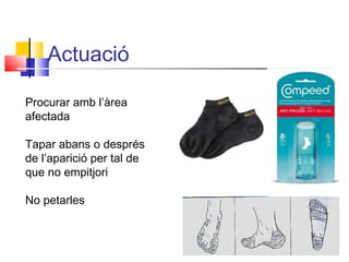 Actuació
Procurar amb l’àrea
afectada
Tapar abans o després
de l’aparició per tal de
que no empitjori
No petarles
 