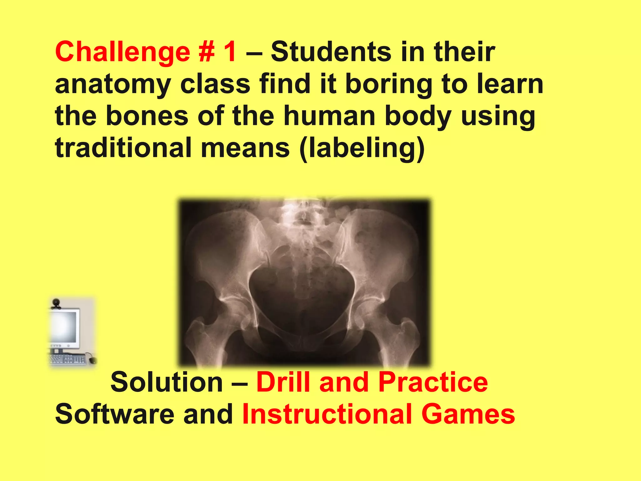 Challenge # 1  – Students in their anatomy class find it boring to learn the bones of the human body using traditional means (labeling) Solution –   Drill and Practice  Software and  Instructional Games 
