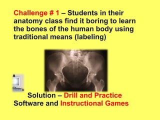 Challenge # 1  – Students in their anatomy class find it boring to learn the bones of the human body using traditional means (labeling) Solution –   Drill and Practice  Software and  Instructional Games 