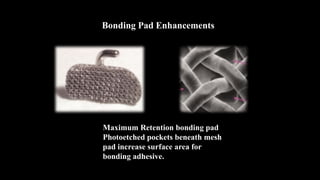 Bonding Pad Enhancements
Maximum Retention bonding pad
Photoetched pockets beneath mesh
pad increase surface area for
bonding adhesive.
 