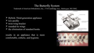 The Butterfly System
 Hybrid, Third-generation appliance
 low-profile
 twin-wing bracket
 rounded tie wings
 the elimination of standard hooks
results in an appliance that is more
comfortable, esthetic, and hygienic.
Trademark of American Orthodontics, Inc., 1714 Cambridge Ave., Sheboygan, MI 53082.
 