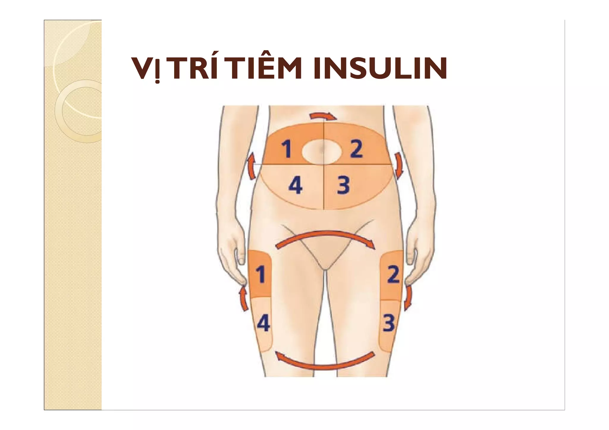 VỊTRÍTIÊM INSULIN
 