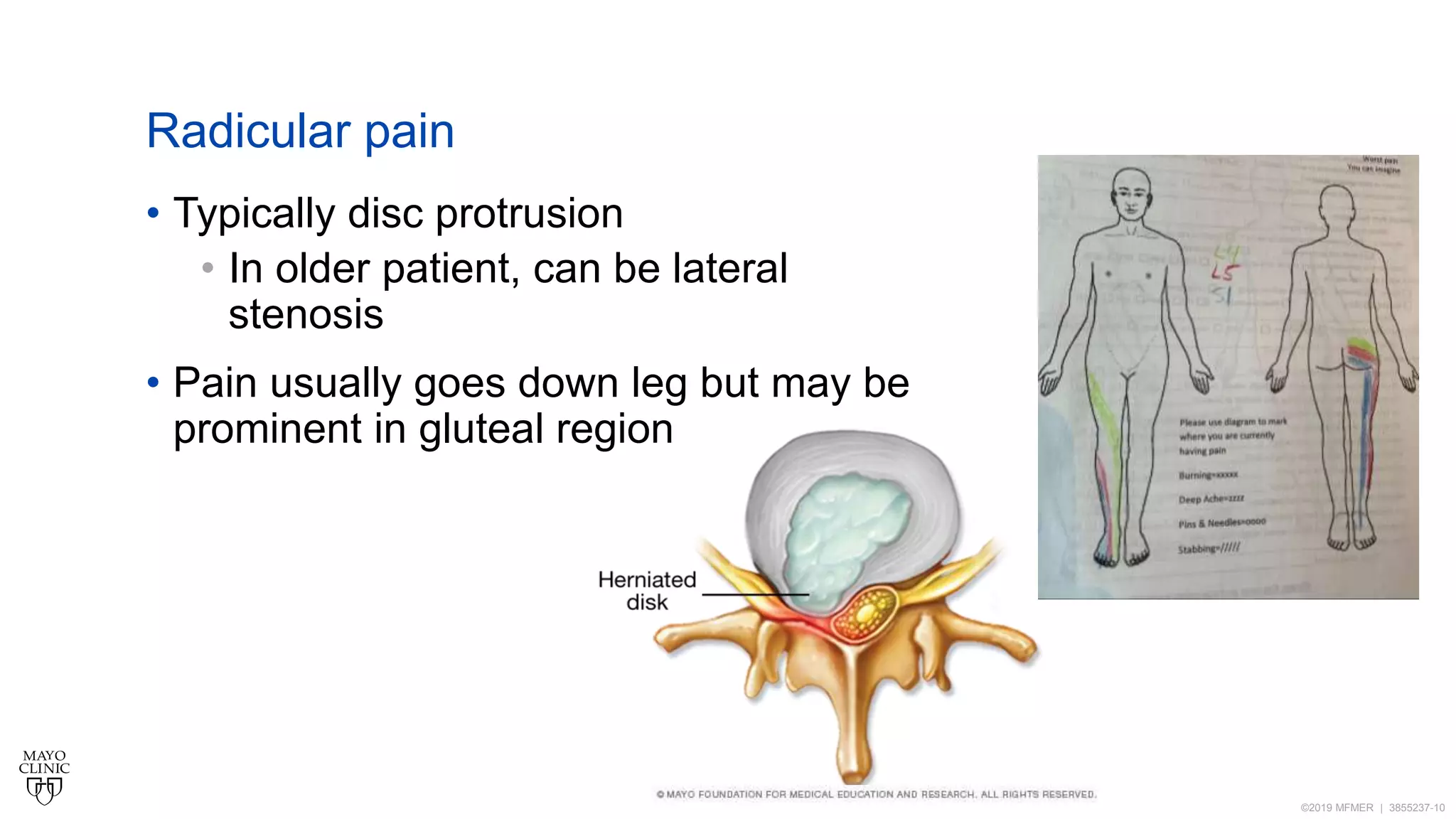 Buttockpainintheathlete | PPT