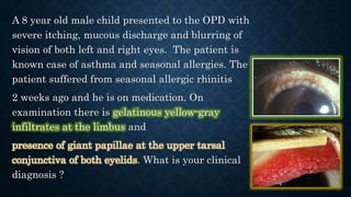 A 8 year old male child presented to the OPD with
severe itching, mucous discharge and blurring of
vision of both left and right eyes. The patient is
known case of asthma and seasonal allergies. The
patient suffered from seasonal allergic rhinitis
2 weeks ago and he is on medication. On
examination there is gelatinous yellow-gray
infiltrates at the limbus and
presence of giant papillae at the upper tarsal
conjunctiva of both eyelids. What is your clinical
diagnosis ?
 