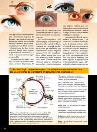 Medicina

volve degeneração macular apresenta
uma característica incipiente da
doença e experimenta apenas uma
perda visual mínima, não evoluindo
para uma forma mais grave. Porém,
em alguns casos, as drusas poderão
evoluir para uma das duas formas
severas da doença: a seca (chamada pelos médicos de atrófica); e a
úmida ou exsudativa (ver destaque
na página 45).
Um exame oftalmológico completo é a melhor maneira de determinar a presença do problema. O

auto-exame em casa com a Grade
de Amsler (faça o teste na página 44)
também é importante para o acompanhamento.
Para um bom diagnóstico, a dilatação das pupilas, com algumas gotas
de colírio, se faz necessária. Depois,
o paciente será examinado com lentes especiais, que possibilitam uma
visão minuciosa da retina em grande
aumento. Com estes procedimentos, o médico passa a observar se
há a presença de líquido ou sangue
sob a retina. Se forem observadas
alterações, indica-se a realização de
angiografias — outro tipo de exame

que detalha o problema com a visualização e estudos dos neovasos,
determinando o tamanho, a posição
e os tipos existentes, além de detectar
se há algum vazamento.
A angiografia, além de não ser
dolorosa, é bastante segura. O paciente senta-se diante de um aparelho
capaz de fotografar a retina e recebe
a injeção de um corante em uma veia
do antebraço ou da mão. A substância
entrará na circulação e, ao chegar à
retina, distingue os vasos sanguíneos
do tecido, o que torna possível realizar uma série de fotografias, com
filtros especiais. A angiografia com
a fluoresceína é muito segura e já foi
realizada em inúmeros pacientes nos

O olho é um órgão complexo composto por várias estruturas anatômicas. Uma
boa visão depende de seu trabalho em conjunto. Estas estruturas são:
Córnea: é uma lente transparente localizada na
parte anterior do olho e ajuda na focalização dos raios
luminosos que entram no globo ocular.
Íris: é a parte colorida do olho. A íris fica dilatada no
escuro e fechada (contraída) se houver muita claridade,
funcionando como o diafragma de uma câmera fotográfica.
Cristalino: é uma lente transparente e flexível que produz
o foco das imagens na retina. Com a idade o cristalino se
opacifica, e então temos a catarata.
Mácula: é o centro da retina, apresentando uma densa
população de fotorreceptores. O ponto central da mácula
é chamado de fóvea e permite a visão de detalhes, como a
leitura e a visualização das fisionomias.
Humor vítreo: é um “gel” transparente que preenche a
cavidade do globo ocular.

Retina: é uma fina película de tecido nervoso composto por dez camadas de células
que recobrem a superfície interna do olho. Uma dessas camadas é formada pelos
fotorreceptores (cones e bastonetes) que são células sensíveis à luz, cuja função é
transformar a luz em impulsos elétricos. Outra camada importante é chamada de epitélio
pigmentado da retina (EPR), que se localiza logo atrás da camada dos fotorreceptores. Sua
função é de absorver o excesso de luz e transportar os nutrientes, oxigênio e os restantes
do metabolismo celular entre os fotorreceptores e a coróide.

42

BOA VONTADE

Nervo óptico: é composto por um feixe de fibras nervosas que carreiam os estímulos visuais da retina ao cérebro.
Coróide: é uma camada de vasos sanguíneos que supre
de oxigênio e nutrientes as camadas externas da retina.
Esclera: é um tecido fibroso, branco, que constitui a parede
do globo ocular.

 