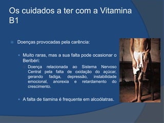Os cuidados a ter com a Vitamina B1Doenças provocadas pela carência:Muito raras, mas a sua falta pode ocasionar o Beribéri: Doença relacionada ao Sistema Nervoso Central pela falta de oxidação do açúcar, gerando fadiga, depressão, instabilidade emocional, anorexia e retardamento do crescimento. A falta de tiamina é frequente em alcoólatras.