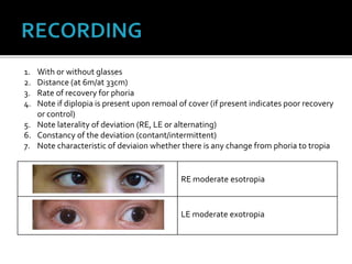 RE moderate esotropia
LE moderate exotropia
1. With or without glasses
2. Distance (at 6m/at 33cm)
3. Rate of recovery for phoria
4. Note if diplopia is present upon remoal of cover (if present indicates poor recovery
or control)
5. Note laterality of deviation (RE, LE or alternating)
6. Constancy of the deviation (contant/intermittent)
7. Note characteristic of deviaion whether there is any change from phoria to tropia
 