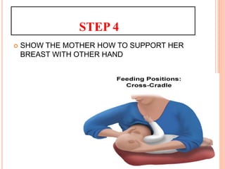 STEP 4
 SHOW THE MOTHER HOW TO SUPPORT HER
BREAST WITH OTHER HAND
 