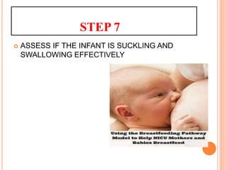 STEP 7
 ASSESS IF THE INFANT IS SUCKLING AND
SWALLOWING EFFECTIVELY
 