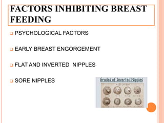 FACTORS INHIBITING BREAST
FEEDING
 PSYCHOLOGICAL FACTORS
 EARLY BREAST ENGORGEMENT
 FLAT AND INVERTED NIPPLES
 SORE NIPPLES
 