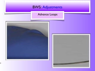 BWS placement and adjustment | PPT