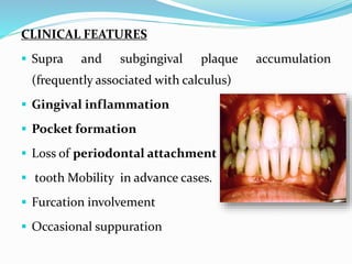 CLINICAL FEATURES
 Supra and subgingival plaque accumulation
(frequently associated with calculus)
 Gingival inflammation
 Pocket formation
 Loss of periodontal attachment
 tooth Mobility in advance cases.
 Furcation involvement
 Occasional suppuration
 