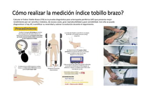 Cómo realizar la medición índice tobillo brazo?
 