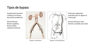 Tipos de bypass
Anastomosis proximal
y distal en el mismo
eje arterial anatómico.
Aorto-femoral,
femoro-popliteo,
femoro tibial,
subclavio-humeral.
Entre dos segmentos
arteriales que no siguen el
mismo eje.
Femoro-femoral, axilo-
femoral, carotido-sub-clavio.
 
