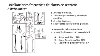 Localizaciones frecuentes de placas de ateroma
estenosantes
1. Arterias coronarias.
2. Troncos supra-aórticos y bifurcación
carotidea.
3. Arterias viscerales.
4. Sector aorto-ilíaco y femoro-poplíteo.
La frecuencia del asentamiento
arterioesclerótico obstructivo en MMII:
A. Sector aortoilíaco 30%
B. Sector femoro-popliteo 50%
C. Sector tibio-peroneo y distal 25%
 