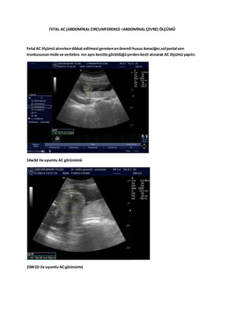 OBSTETRİK ULTRASONOGRAFİ | DOCX