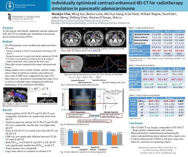 Individually Optimized ContrastEnhanced 4DCT for Radiotherapy Simul…