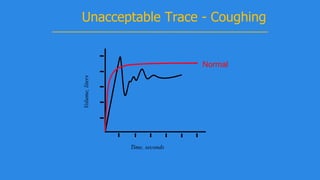 Volume,liters
Time, seconds
Unacceptable Trace - Coughing
Normal
 